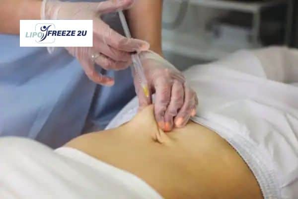 Fat Dissolving Injections Didcot & Weight loss medication