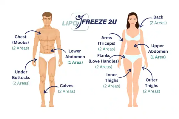 Areas you can have fat freezing treatment Didcot