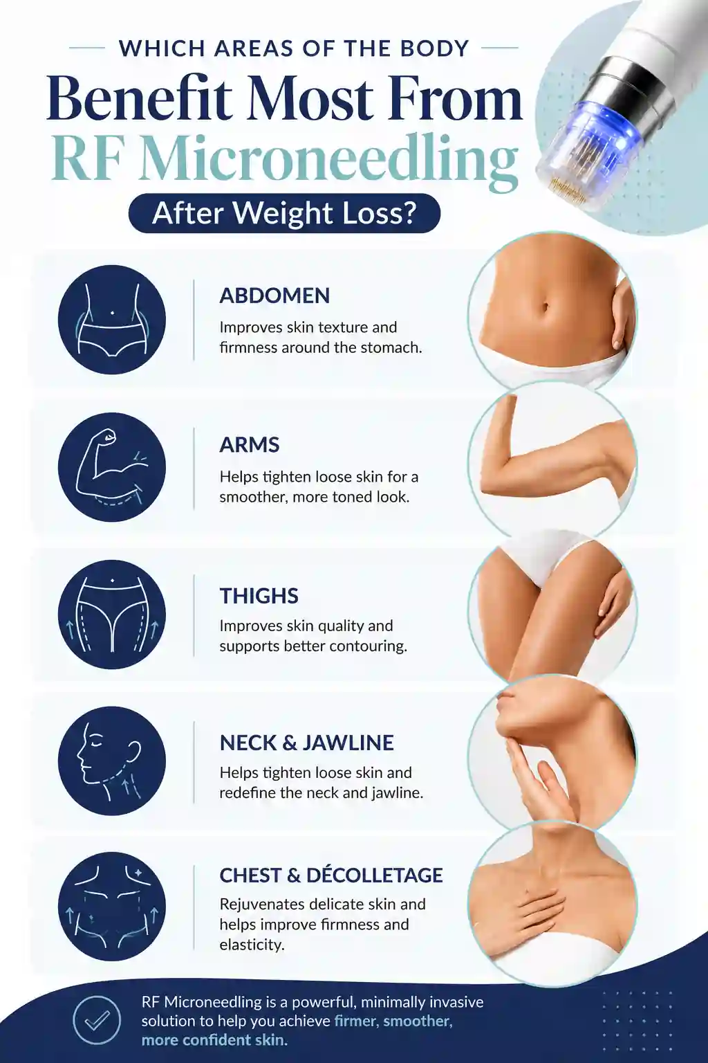 Which Areas of the Body Benefit Most From RF Microneedling After Weight Loss Didcot